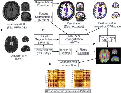 Structural Connectivity Alterations in Amyotrophic Lateral Sclerosis: A Graph Theory Based Imaging Study